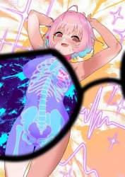 1193158 B